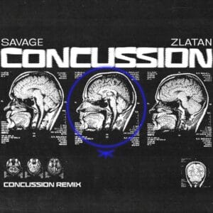 Savage & Zlatan - Concussion Remix 